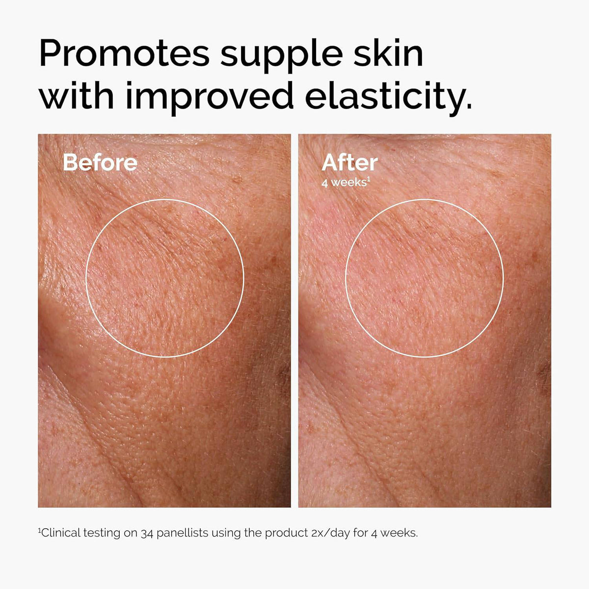 SlimBag The Ordinary Serum Favorites Set with hydrating hyaluronic acid, brightening niacinamide, and caffeine eye serum for skincare.